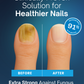 Podiatrist Formula Nail Revive